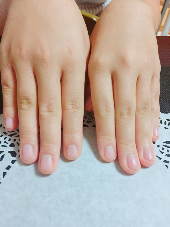 爪を噛む癖 草加市青柳ネイルサロン35歳からの大人女性の為のネイルサロン 魅せる大人のシンプルネイル 自爪 の健康を守るベース1層残しのフィルイン対応のヴェルニ