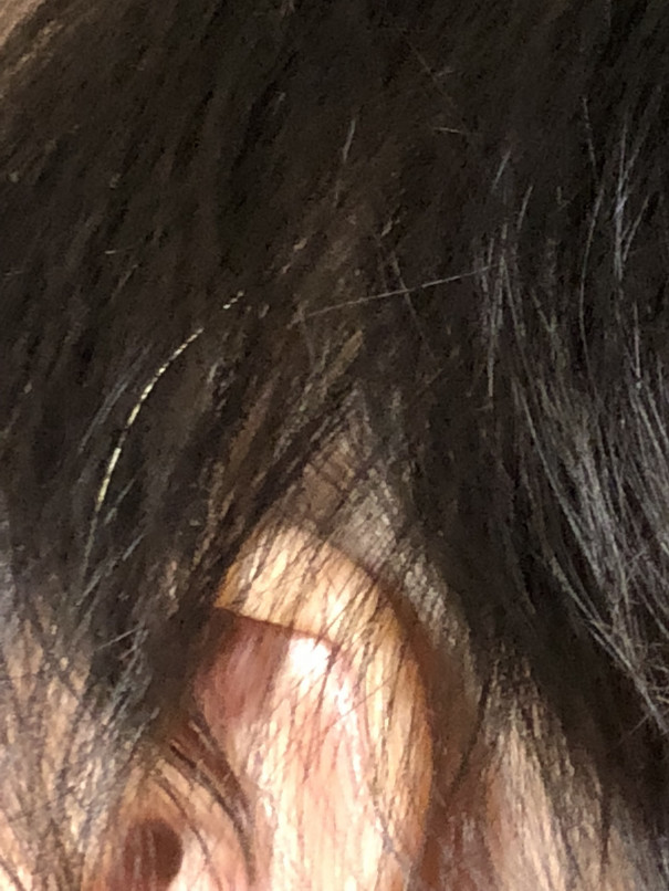 宝毛 おちびの成長life 宝毛 おちびの成長life
