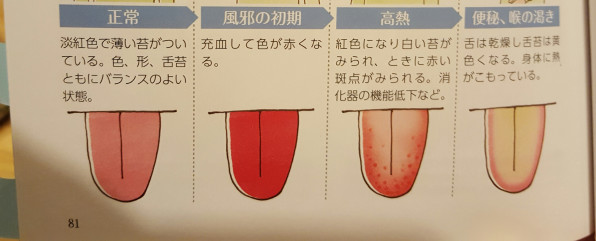 私の舌からわかること はりきゅう 縁