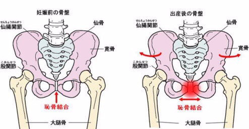 産後の骨盤調整 つきもり鍼灸整骨院