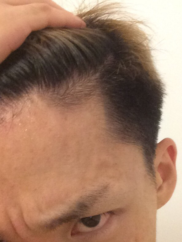 その他ヘアケア ハゲる原因ついに判明 夏にあった事実 Yuji Okoshi Web Site その他ヘアケア ハゲる原因ついに判明 夏にあった事実 Yuji Okoshi Web Site