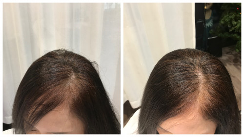 ヘアループ モニター様ご紹介 Lapark Saku ヘアループ モニター様ご紹介 Lapark Saku