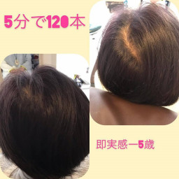 増毛 米子 Lapark Saku 増毛 米子 Lapark Saku