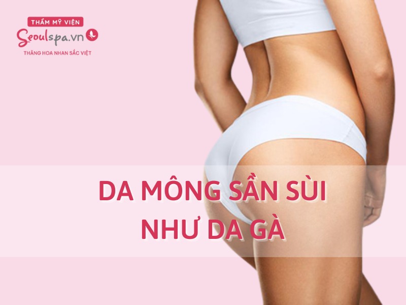 4. Ngăn Ngừa Tình Trạng Da Mông Sần Sùi