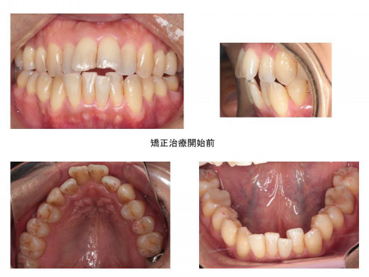 調布柴崎歯科クリニック 症例集