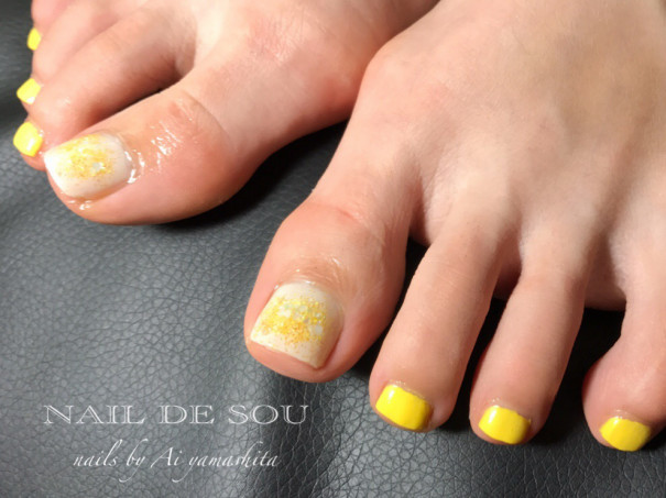 巻爪さんのフットネイルはマニキュアがいい Nail De Sou