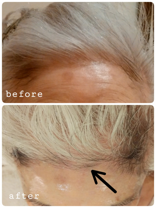 白髪が黒髪に変わった Healing Port