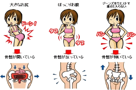 骨盤周りの出っ張り気になってませんか ゆうき整骨院 骨盤周りの出っ張り気になってませんか ゆうき整骨院