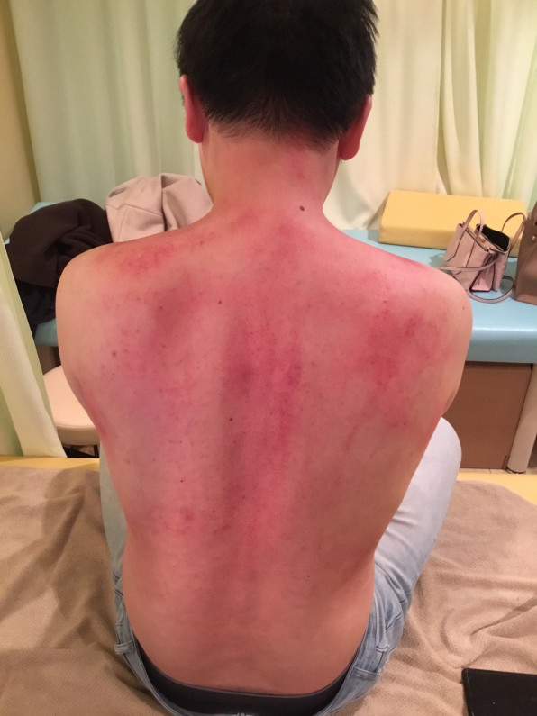 免疫力 こみなみ整骨院 整体院 根本治療 筋膜リリースなどの最新治療もお任せください 名古屋市千種区仲田