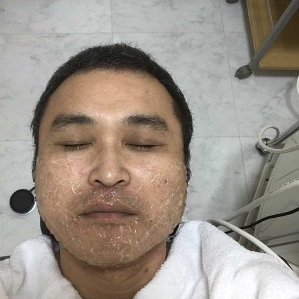 さまよう アクセル 望遠鏡 髭 脱毛 7 回目 Aburiyaki Ungasouko Com さまよう アクセル 望遠鏡 髭 脱毛 7 回目 Aburiyaki Ungasouko Com