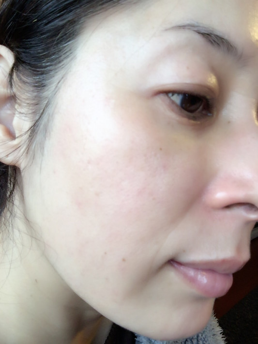 朝顔を洗わない美容法 美肌は無敵 ブランシュの美肌生活