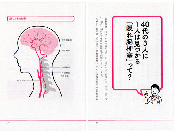 隠れ脳卒中 イラスト Hosokawa Natsuko Homepage