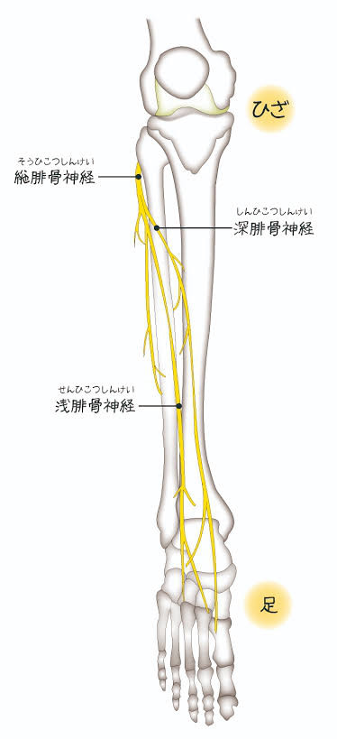 腓骨神経麻痺 悠鍼灸院 伏見院