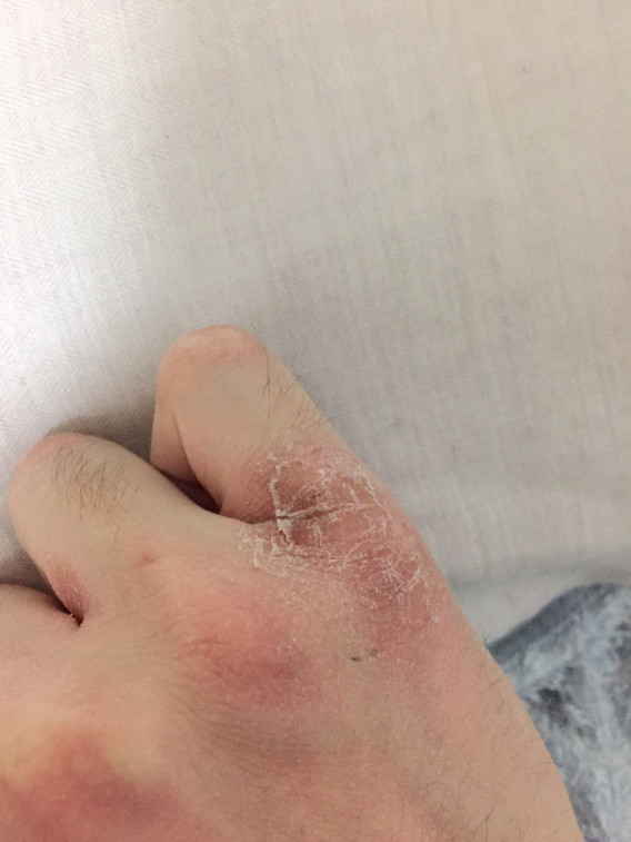 グロ注意 メキレシアの布団の中