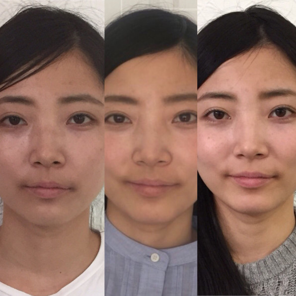 結婚式当日まで ビフォーアフター 笑顔コーチングサービス Redere リーデレ