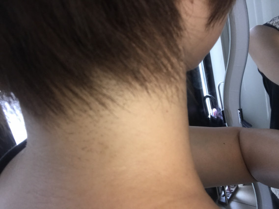 ムダ毛 リンパ屋laugh