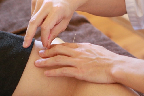 鍼灸 Q&A | 質の高い鍼灸をすべての人に 朝霧高原治療院 鍼灸｜富士市 石坂