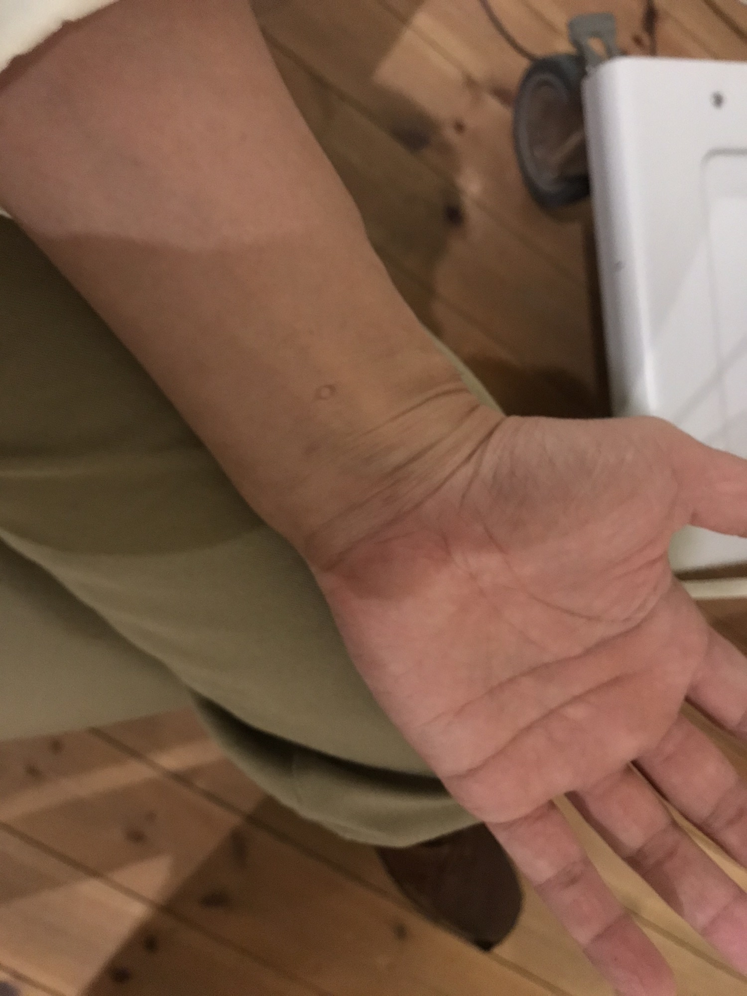 脳卒中に対する鍼【醒脳開竅法】 | 質の高い鍼灸をすべての人に