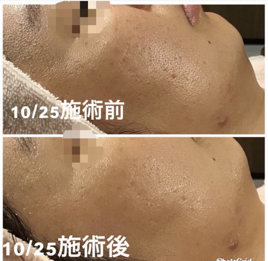 エンビロン成果 エンビロン正規代理店 Unerencontre ユヌ ランコント