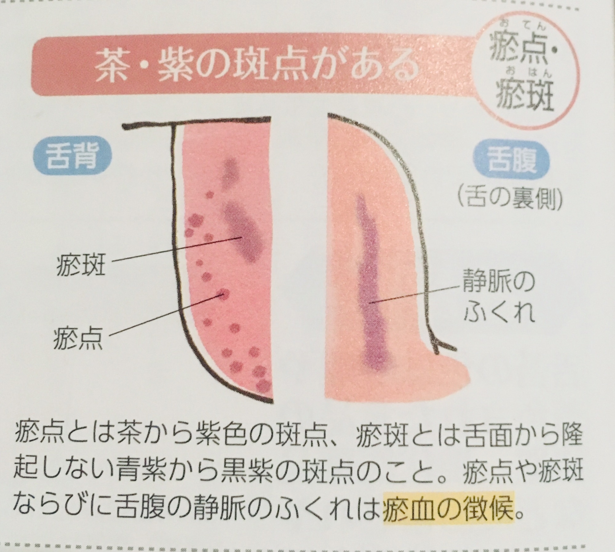 舌診とよもぎ蒸しとファスティング トークセンタイマッサージsunari