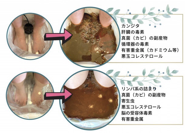 毒素開放デトックス | シータヒーリング東京府中_ヒーリングスクール&サロン府中ワルツ