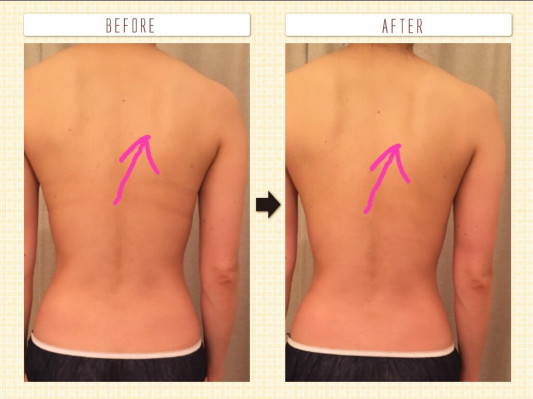 肩甲骨を綺麗に出しましょう Private Salon An