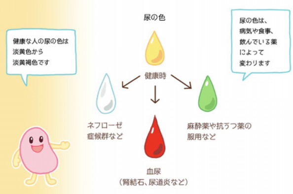 老廃物を溜めない Island