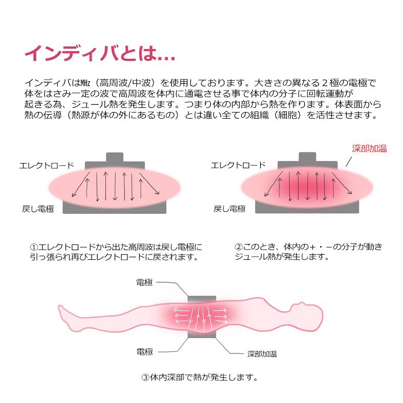 インディバ 板型戻し電極 新品 - その他