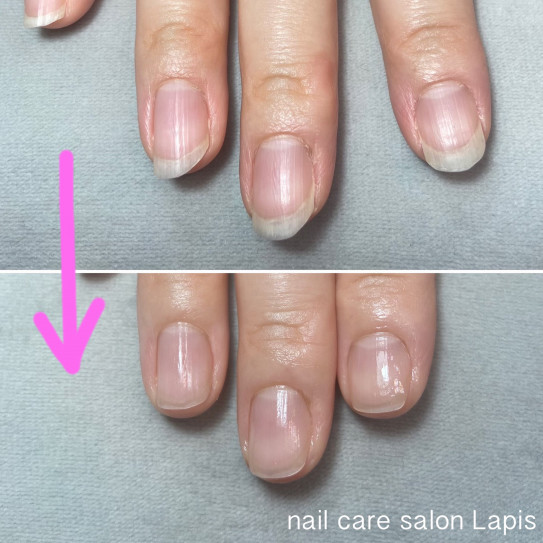 自爪育成ネイルケア Nail Care Salon Lapis