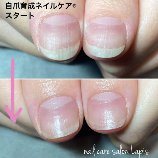 自爪育成ネイルケア スタート Nail Care Salon Lapis