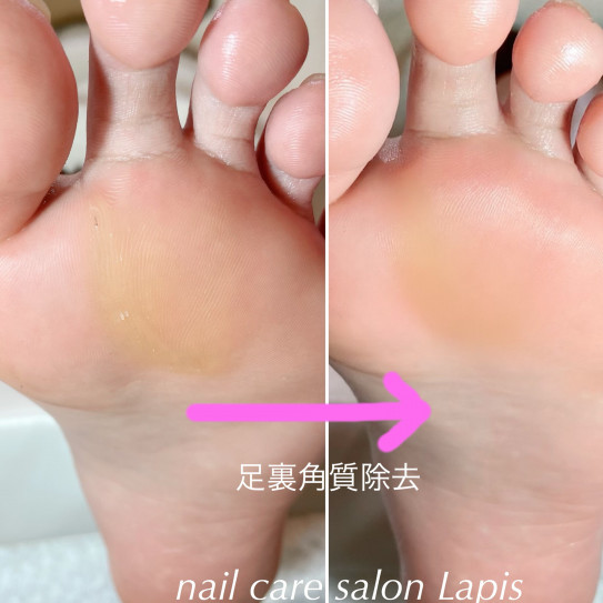 足裏角質除去 つるつる Nail Care Salon Lapis