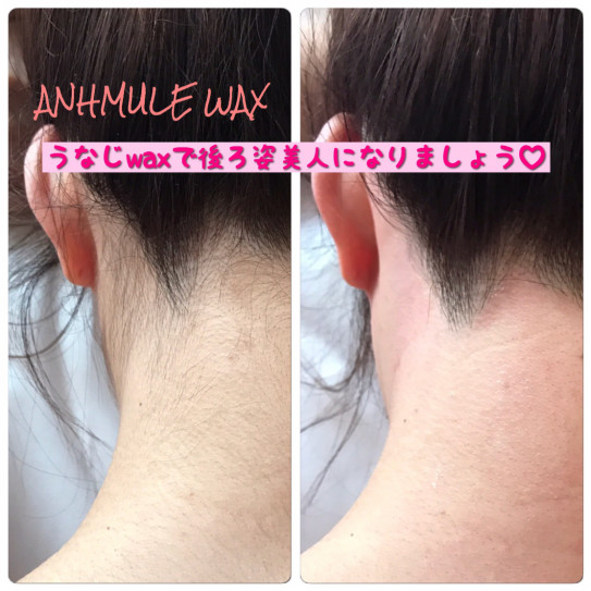 うなじも綺麗にしてアップスタイル楽しみましょう Brazilian Wax Anhmule