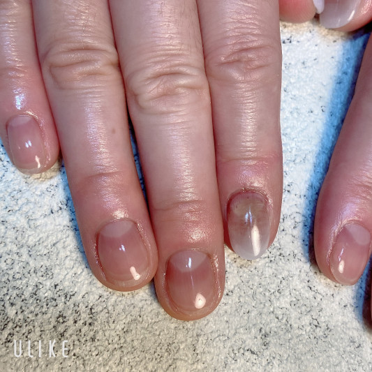 深爪さん 途中経過 Chloe Nail Design