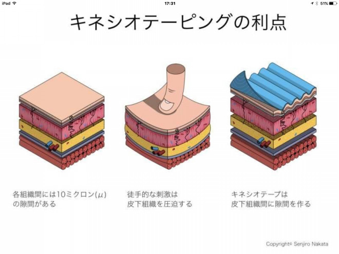 テーピングの効果は 自然治癒力upです 薬は付いていませんよ ゼロです のコピー キネシオスペース ルナ