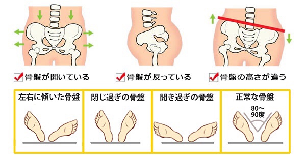 今すぐ骨盤の歪みをチェック 癒 美 You Me Re Birth Place