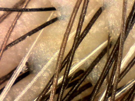 白髪をスコープで見てみて思う事 大阪豊中美容室bolge須山絵津子