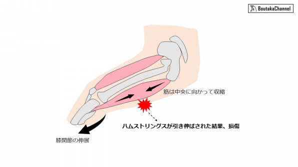 もうハムストリングスの肉離れはしたくない 効果的な予防法とは 1 メカニズムと要因について Boutaka Channel