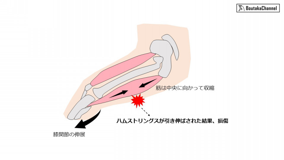 もうハムストリングスの肉離れはしたくない 効果的な予防法とは 1 メカニズムと要因について Boutaka Channel