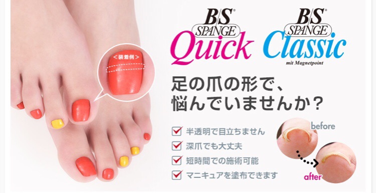 巻き爪ケア（B/Sブレイス）について | private nail salon omi