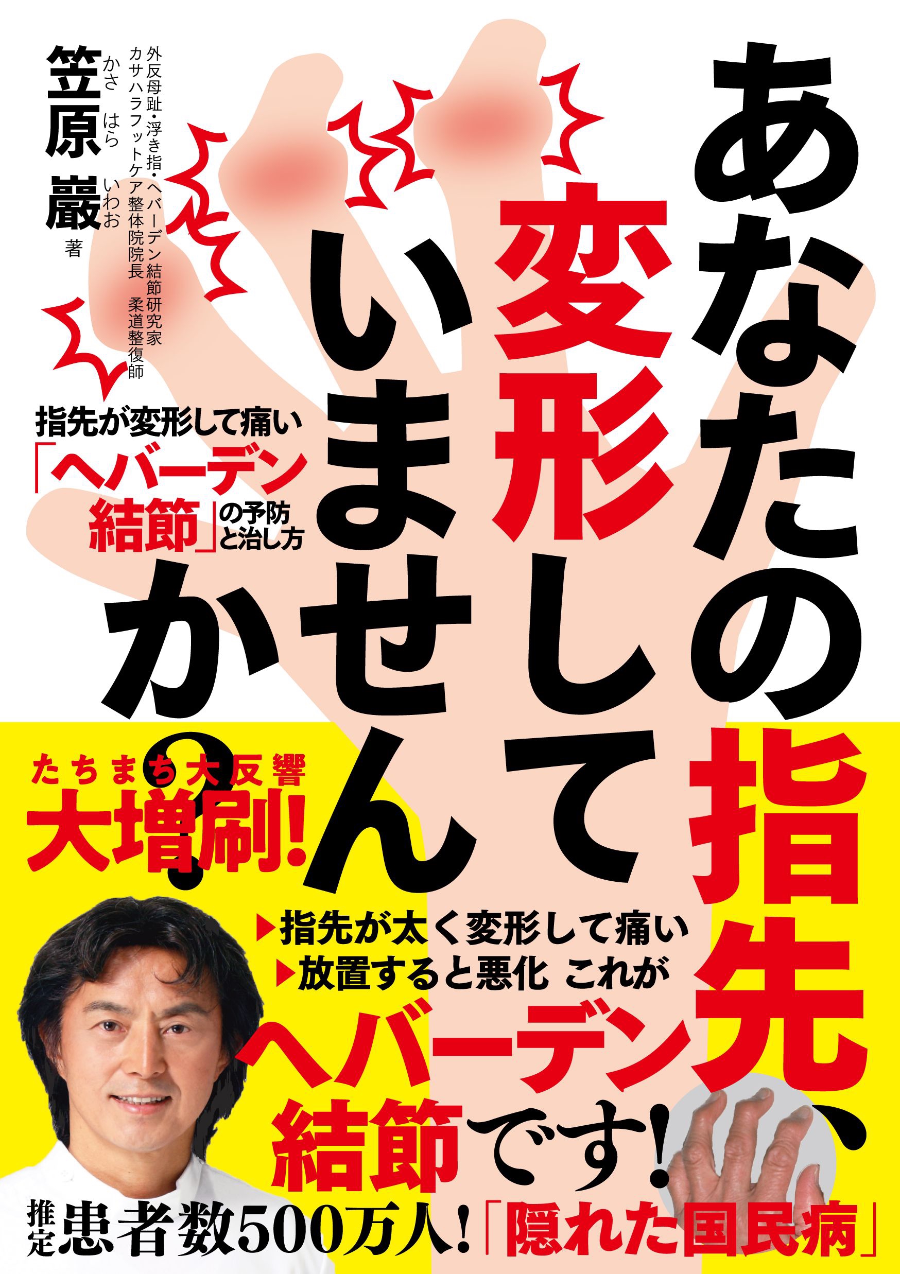 大好評発売中 あなたの指先 変形していませんか 指先が変形して痛い へバーデン結節 の予防と治し方 一部原稿を読めます 自由国民社フリーリーディングスペース