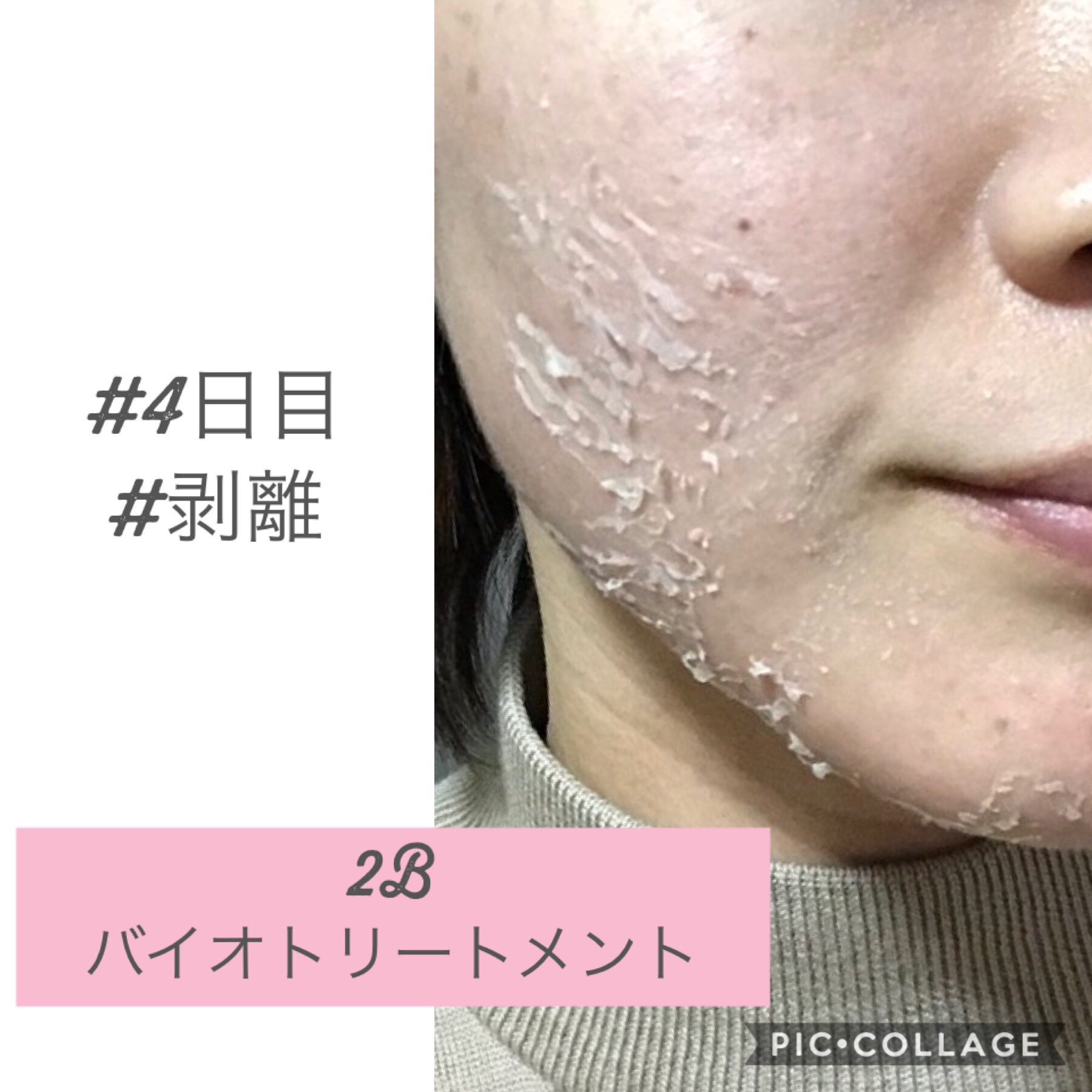 2B Bio ニュージェネレーションパウダー【5グラム×5包】 - その他