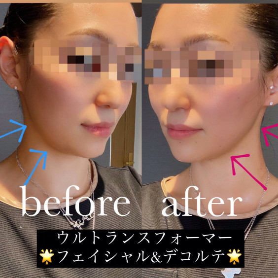 お顔も筋膜ケア Total Beauty Salon Luz