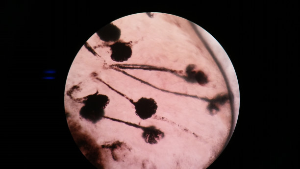 生物基礎 実験 糸球体 墨汁にて可視化 Biology Study Group For Students And Teachers