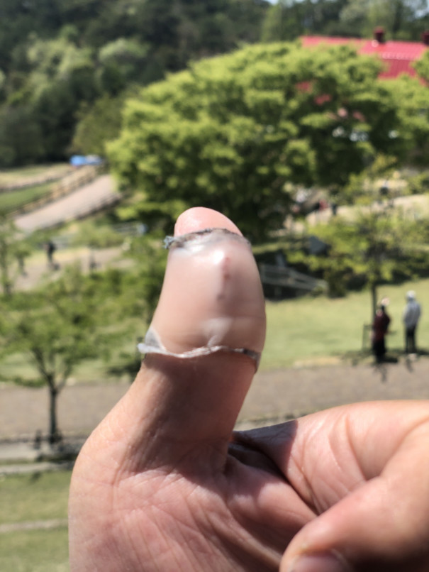 バンドエイドの進化 うなぎ1号の心の絆創膏 バンドエイドの進化 うなぎ1号の心の絆創膏