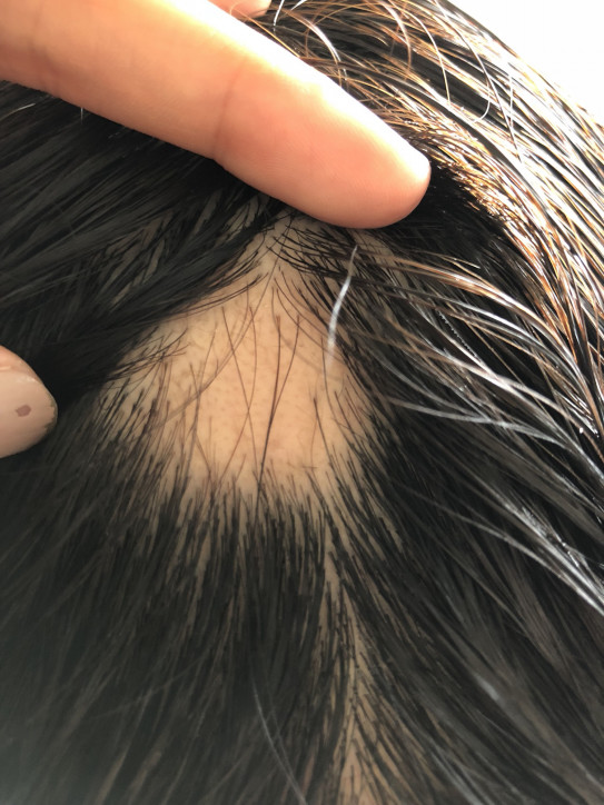 約1ヶ月後 増毛エクステnaturelle 約1ヶ月後 増毛エクステnaturelle