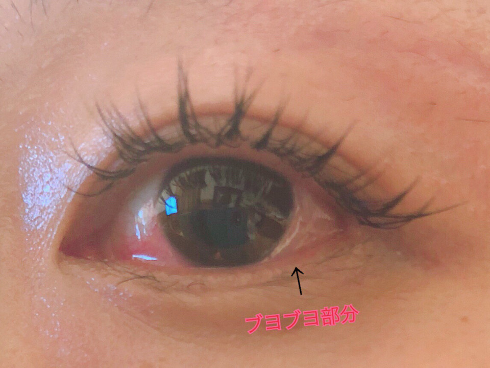 アレルギー について Eyelash Uk