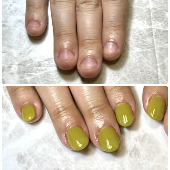 深爪でピンクの部分を伸ばしたい 佐世保市ネイルサロン 爪が傷まず上品なネイルのキヨノネイル