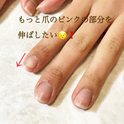 爪のピンクの部分を長くしたい 佐世保市ネイルサロン 爪が傷まず上品なネイルのキヨノネイル