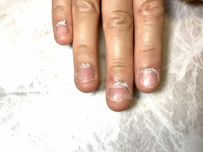 爪のお悩み ささくれのもとになる甘皮のお手入れ 佐世保市相浦ネイルサロン お爪の健康にこだわり指先のキレイを叶えるキヨノ ネイル