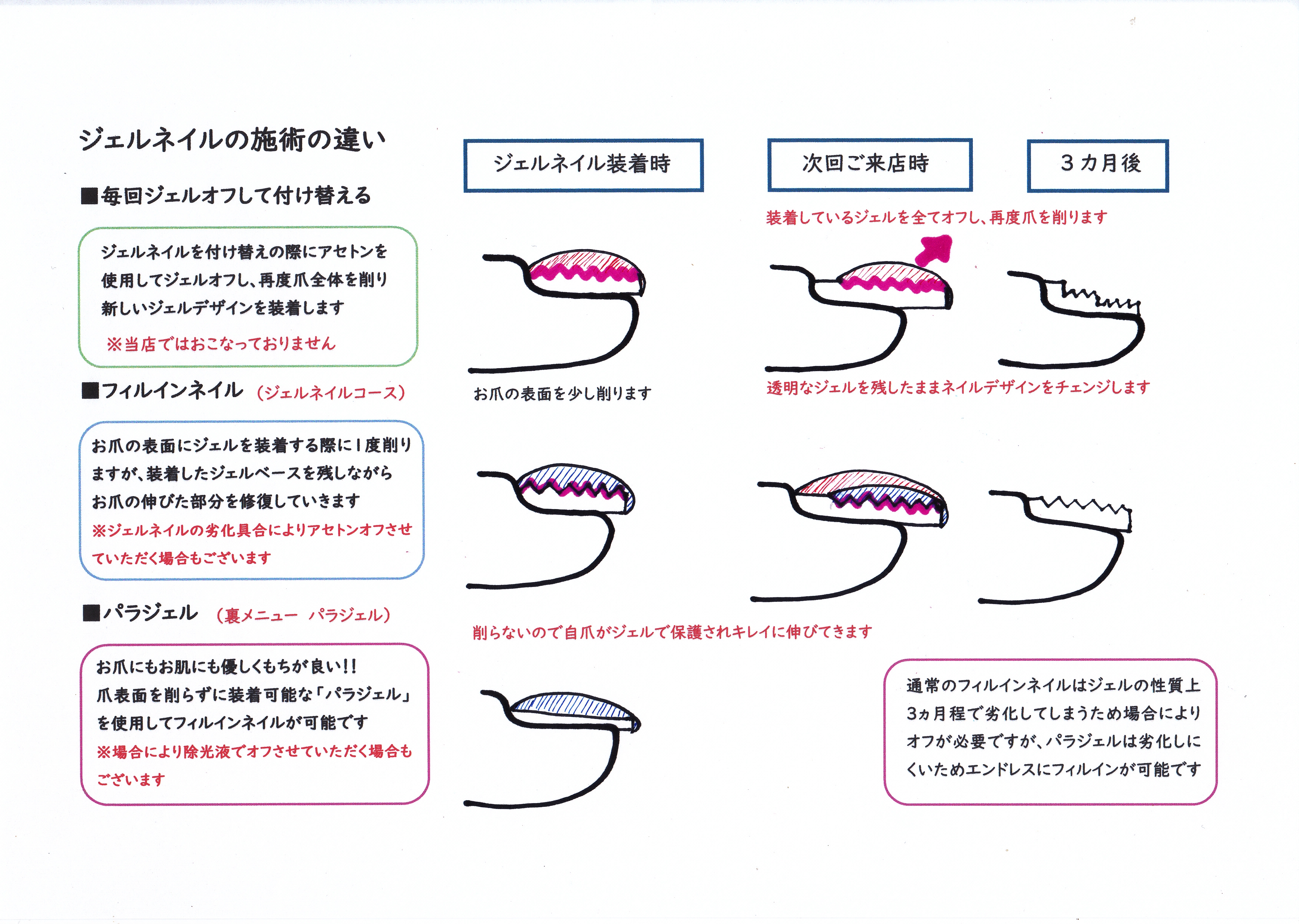 ジェルオフ フィルインネイル パラジェル ジェルネイルの違いについて 佐世保市ネイルサロン ネイルスクール 深爪育成ができるキヨノネイル